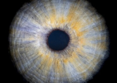 Wow #15 – Notre oeil est unique